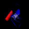 5.png 3D Model of the Heart with Tetralogy of Fallot, parasternal long axis