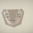 Snapshot_2017-3-1_13-13-32.jpg STL file Digital Dr.Williams's Ortho Appliance・3D print object to download