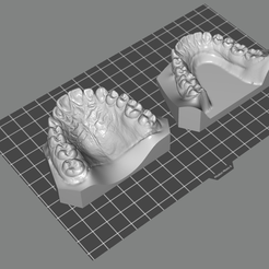 Models.png Fichier STL Modèle d'étude dentaire・Objet pour imprimante 3D à télécharger