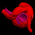 10.png 3D Model of Double Aortic Arch