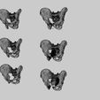 pelvis-fracture-classifications-3d-model-blend-45.jpg Pelvis fracture classifications 3D model