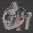 9.png 3D Model of the Heart with Tetralogy of Fallot, parasternal long axis