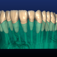 Screenshot_1.png Phantom dental model for dental technicians