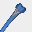 Bone-plates.jpg Bone plates, femur