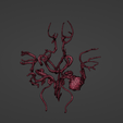 t6.png 3D Model of Middle Cerebral Artery (MCA) Aneurysm