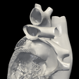 3.png 3D Model of Heart (apical 2 chamber plane)