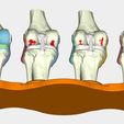 7.jpg total knee replacement model ( TKR ), EDUCATING / TEACHING MODEL