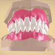 Screenshot_4.png Full Dentures with Many Production Options