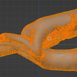 23.png 3D Model of Double Aortic Arch