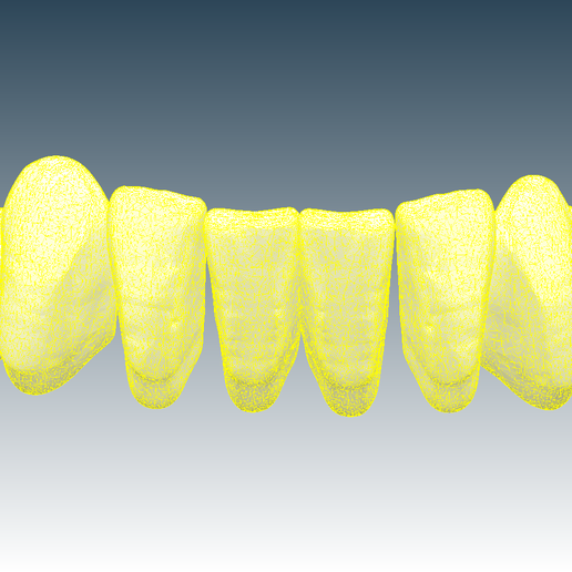 Screenshot_6.png Download OBJ file Digital Full Dentures for Gluedin Teeth with Manual Reduction • 3D printable design, LabMagic3DCAD