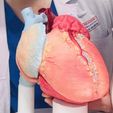 heart,-cardiac,-left,-right,-atrium,-ventricle,-coronary,-artery,-vein,-vena-cava,-aorta,-pulmonary,.jpg Ultra Realistic High-Resolution 3D Normal Heart Model with Aorta, Pulmonary Artery & Vein, Coronary Artery & Vein, Pulmonary & Aortic Valves, Mitral Valve, and Tricuspid Valve
