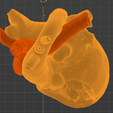 14.png 3D Model of Heart after Fontan Procedure