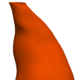 3.png Model of an abdominal aortic aneurysm from a real patient