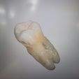 IMG_20220920_155917.jpg 2x real, tooth, tooth 3dscan 15 and 17