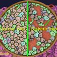 ps17.jpg Diabetes pancreas anatomy microscopy islet beta insulin model