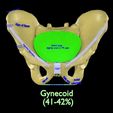 pelvis-types-hip-bone-labelled-detailed-3d-model-0160d9412e.jpg Pelvis types hip bone labelled detailed 3D model
