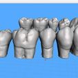 Dentes-Mandibula-Robtoly-Unique-Exocad-03.jpg Teeth Lower Jaw - Exocad - Robtoly-Unique