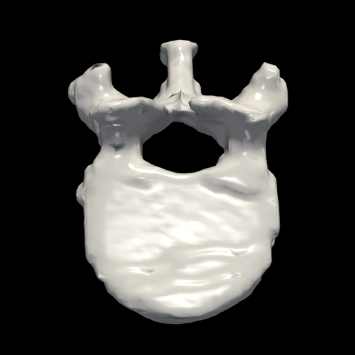 STL File 3d Model Of Thoracic Vertebrae・Template To Download And 3D ...