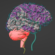 8.png 3D Model of Brain and Aneurysm