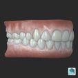 06_MAYA.jpg Human teeth with gums