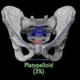pelvis-types-hip-bone-labelled-detailed-3d-model-0b4570d9dd.jpg Pelvis types hip bone labelled detailed 3D model