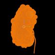 12.jpg 3D Model of Polycystic Kidney