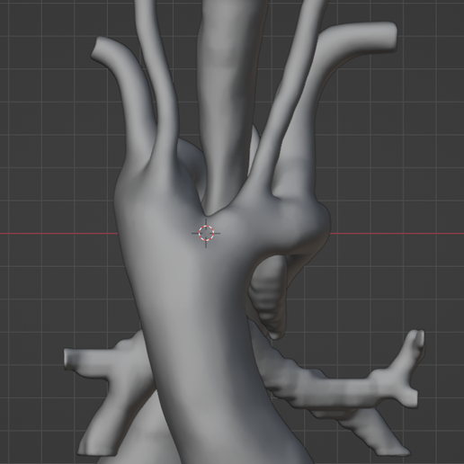 28.png 3D Model of Double Aortic Arch