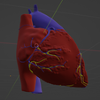 11.png 3D Model of Heart with Transposition of the Great Arteries, long axis view