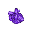 heart with transposition of great arteries.obj 3D Model of Heart with Atrial Septal Defect