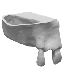 Seno-maxilar-1.png Fichier STL Modèle de sinus maxillaire・Plan à imprimer en 3D à télécharger