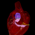 5.png 3D Model of Heart wirh Atrioventricular Septal Defect, 4 chamber view