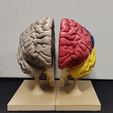1687378174369.jpg Brain for human anatomy study, Split hemispheres + support.