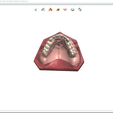 Screenshot_11.png Digital Try-in Full Dentures for Injection Molding