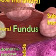 0004.jpg Fibroid Uterus Human female 3D