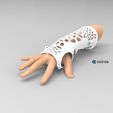 untitled.116.jpg STL file Arm splint・Template to download and 3D print