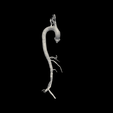 2.png 3D Model of Aorta and Aortic Vessel Tree - generated from real patient