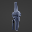 K7.png Knee Replacement