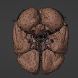 10.png 3D Model of Brain and Blood Supply - Circle of Willis