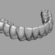 Captura-de-tela-2023-10-24-112835.png dental prosthesis
