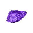 STL00002.stl 3D Model of Human Heart with Anomalous Pulmonary Venous Drainage (APVC) - generated from real patient