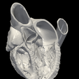 3.png 3D Model of Heart (apical 3 chamber plane)