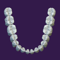 DENTURE-MANDIBULAIRE-pour-partage.png Mandibular teeth