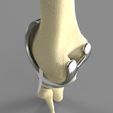 untitled.17.jpg Knee Replacement