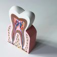 d27f5df4-5313-4d64-816a-c130bce93949.jpg Healthy Tooth Model