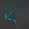 w25.png 3D Model of Brain Arteriovenous Malformation
