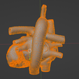 29.png 3D Model of Common Arterial Trunk Truncus Arteriosus