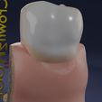 aa0015.jpg Corte esquemático de los dientes etiquetado