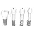 Dental_AO.png Dental Implant Pack - 6 in 1