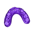 2024-11-18_00003-D-011-16-digitalwaxupmodel.stl D.1 Maxillary bridge inlay-cores