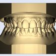 1.jpg dental model nice